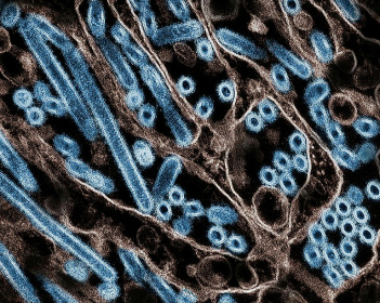 The United States has recorded 66 cases of bird flu in humans since the start of 2024, according to the US Centers for Disease Control and Prevention (CDC), with only one so far resulting in death